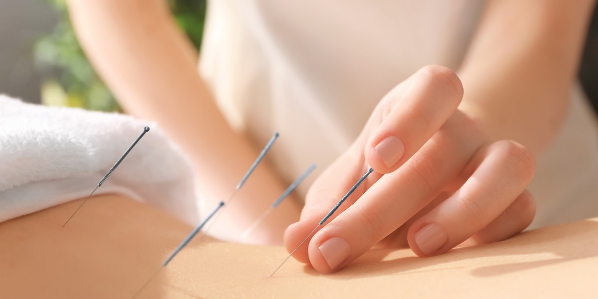 The Potential Benefits of Fertility Acupuncture